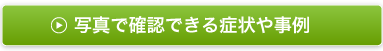 写真で確認できる症状や事例